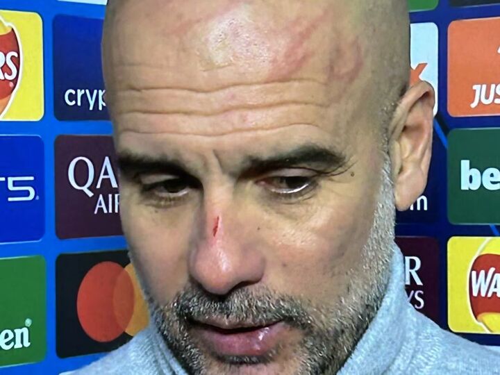 ‘I wanted to do myself damage’ Pep appears in front of press with marks on head