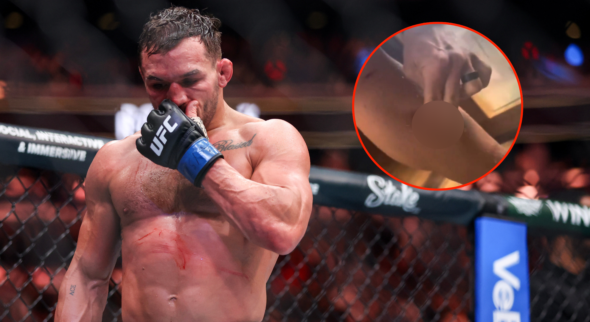 Michael Chandler shares dent-like scars almost two full weeks after UFC 309 loss to Charles Oliveira