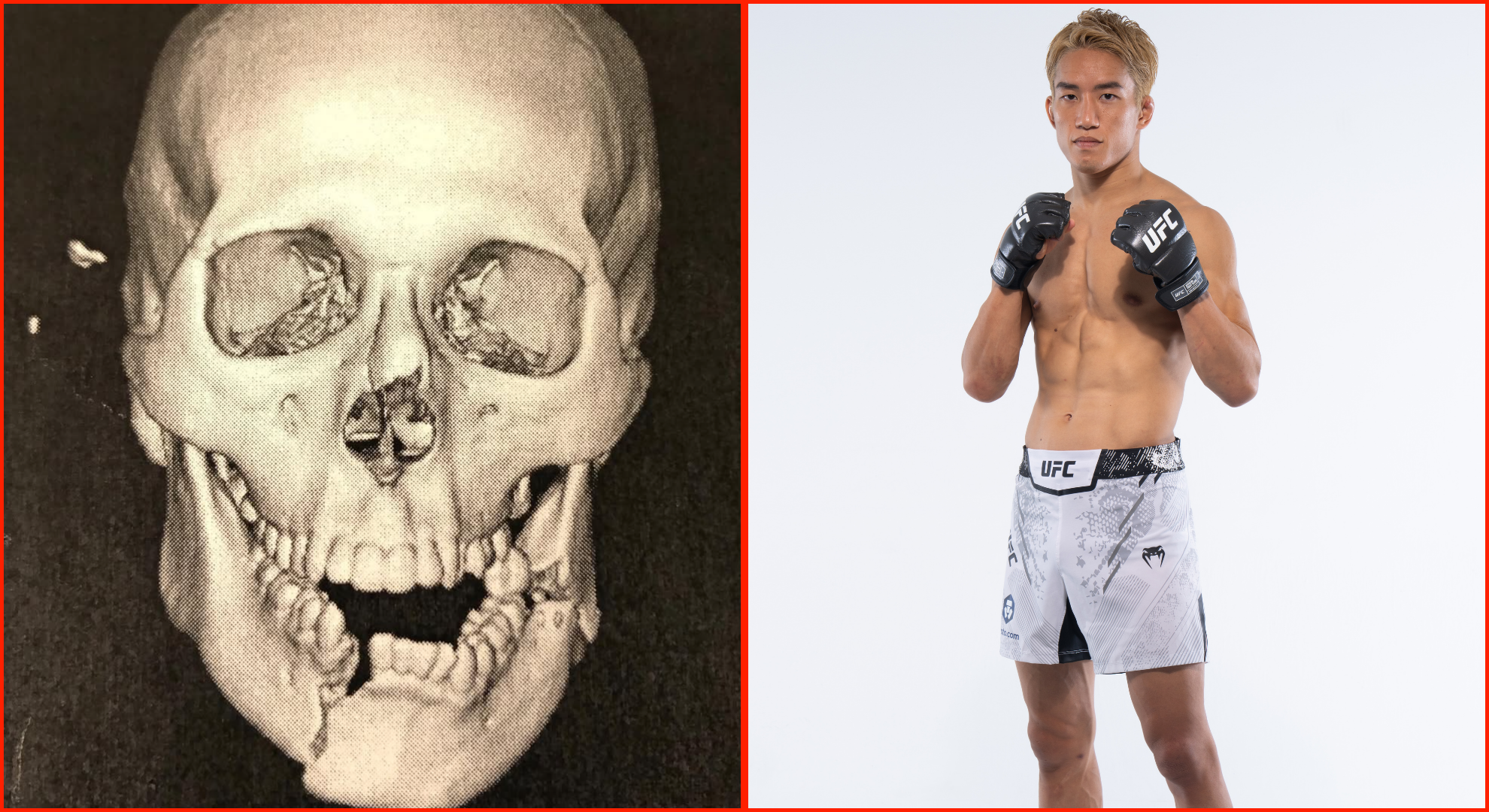 Kai Asakura once broke his opponent’s jaw in two places with kicks so brutal that they’re illegal in the UFC