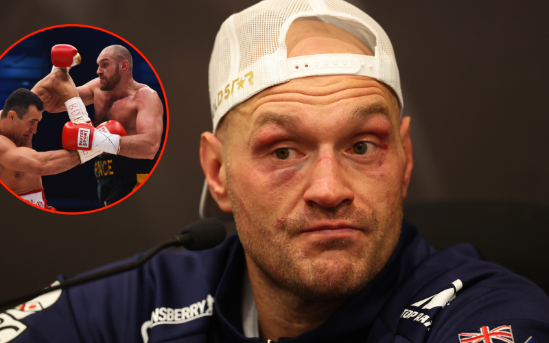 Tyson Fury reacts to rival Wladimir Klitschko’s rumored comeback, talks of a potential rematch