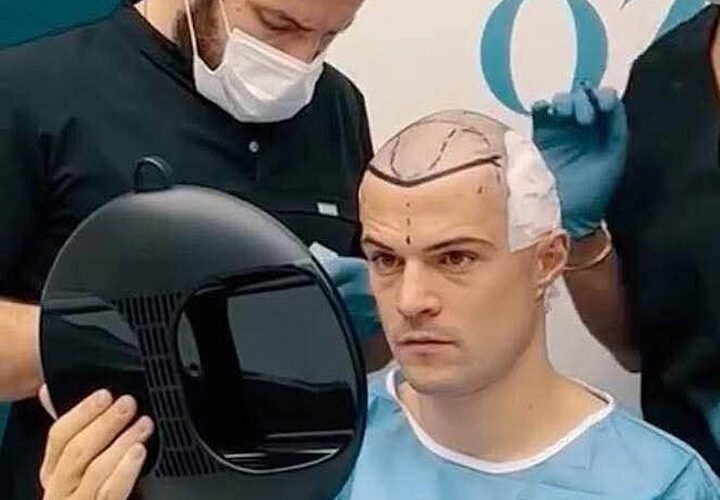 Xhaka reveals the reason for his new haircut that he first debuted on a ski trip