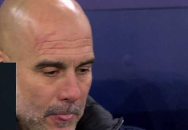 Pep spotted with scratches on head AGAIN as City play hard to reach play-off