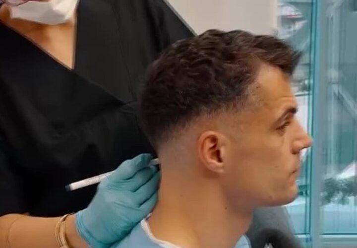 Granit Xhaka reveals reason for dramatic new look with ex-Arsenal star having undergone hair transplant