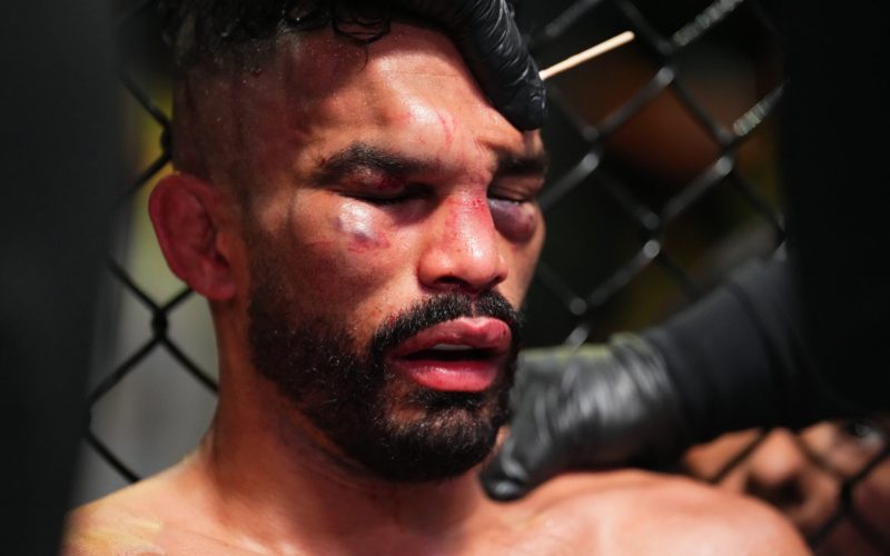 Rob Font was left disfigured in record-setting fight with UFC bogeyman Marlon ‘Chito’ Vera