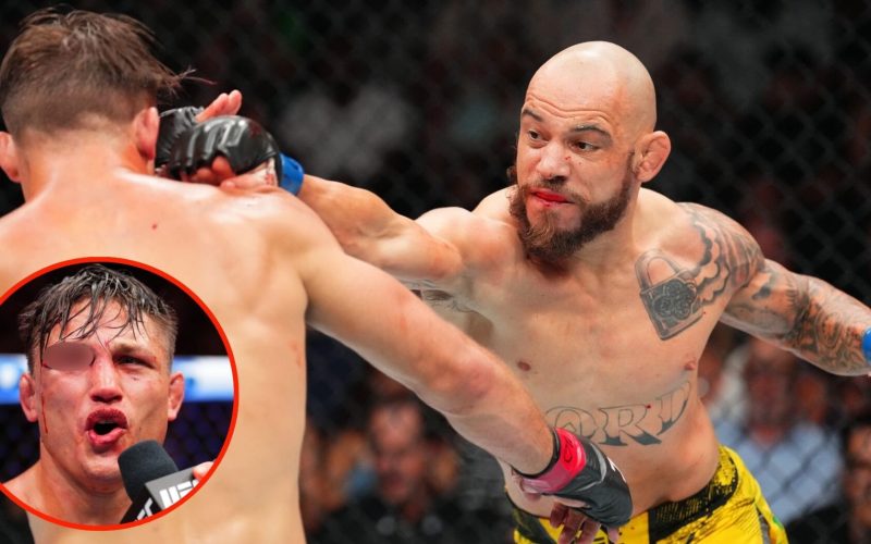 UFC slugger was left with eyebrow hanging off after losing to ‘Fighting Nerd’