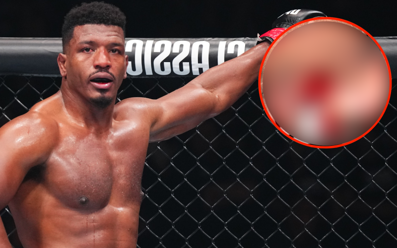 ‘That is nasty!”… Alonzo Menifield suffered horrific foot injury in three-round battle at UFC Seattle