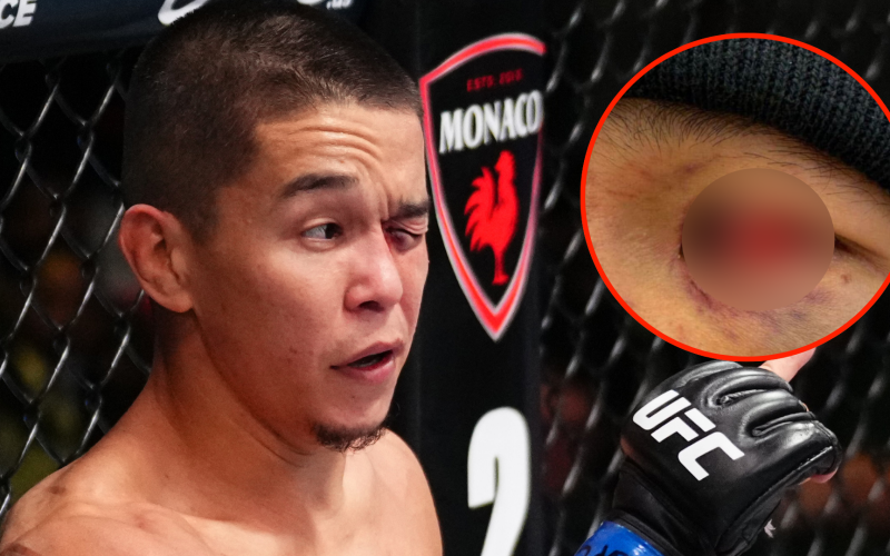 Asu Almabayev shares graphic images of eye injury days after controversial loss at UFC Vegas 103