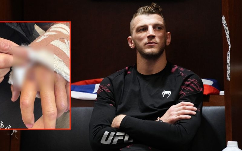 Dan Hooker calls out top contender for UFC 317 fight after showing off gruesome hand injury